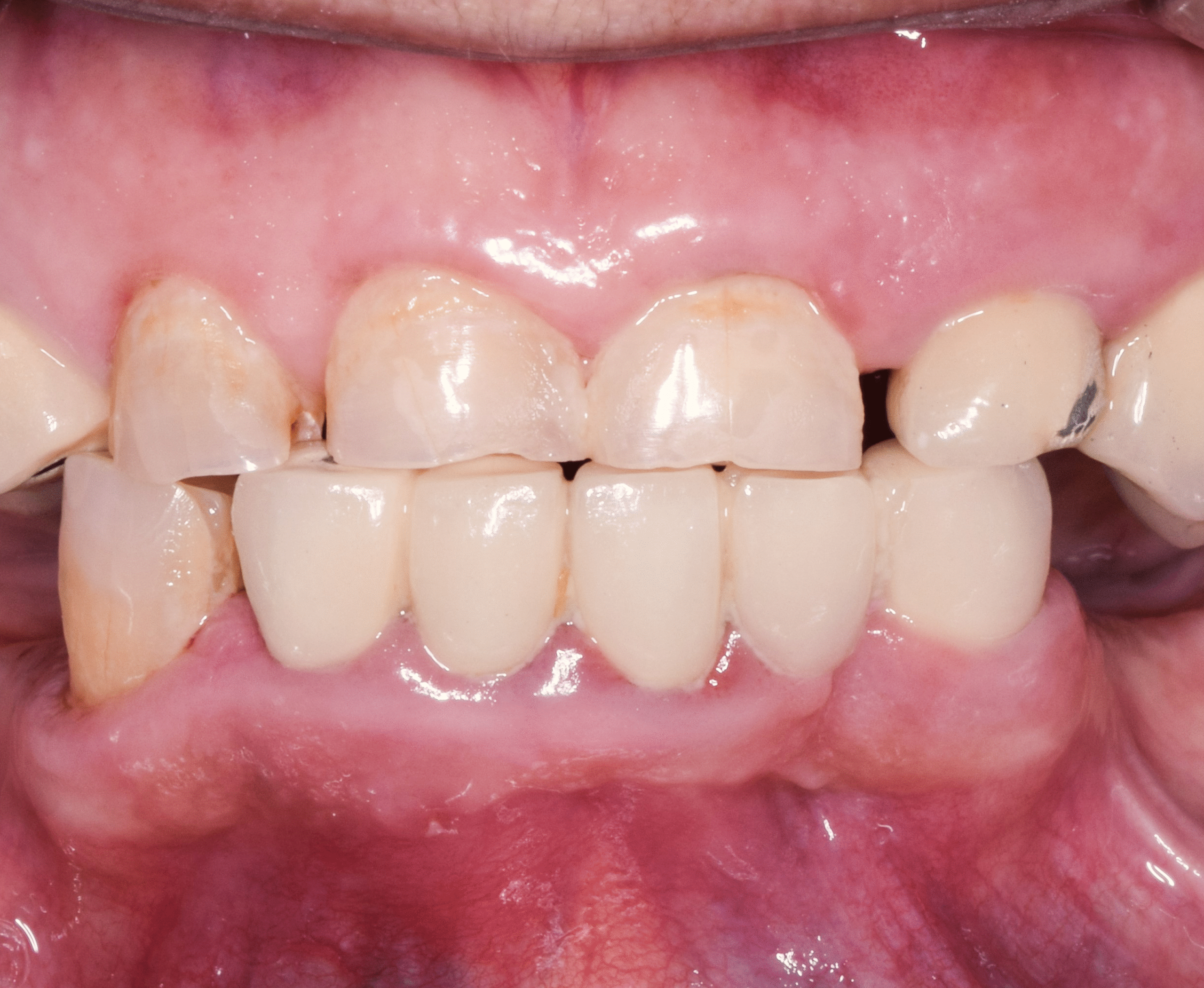 Before image alt