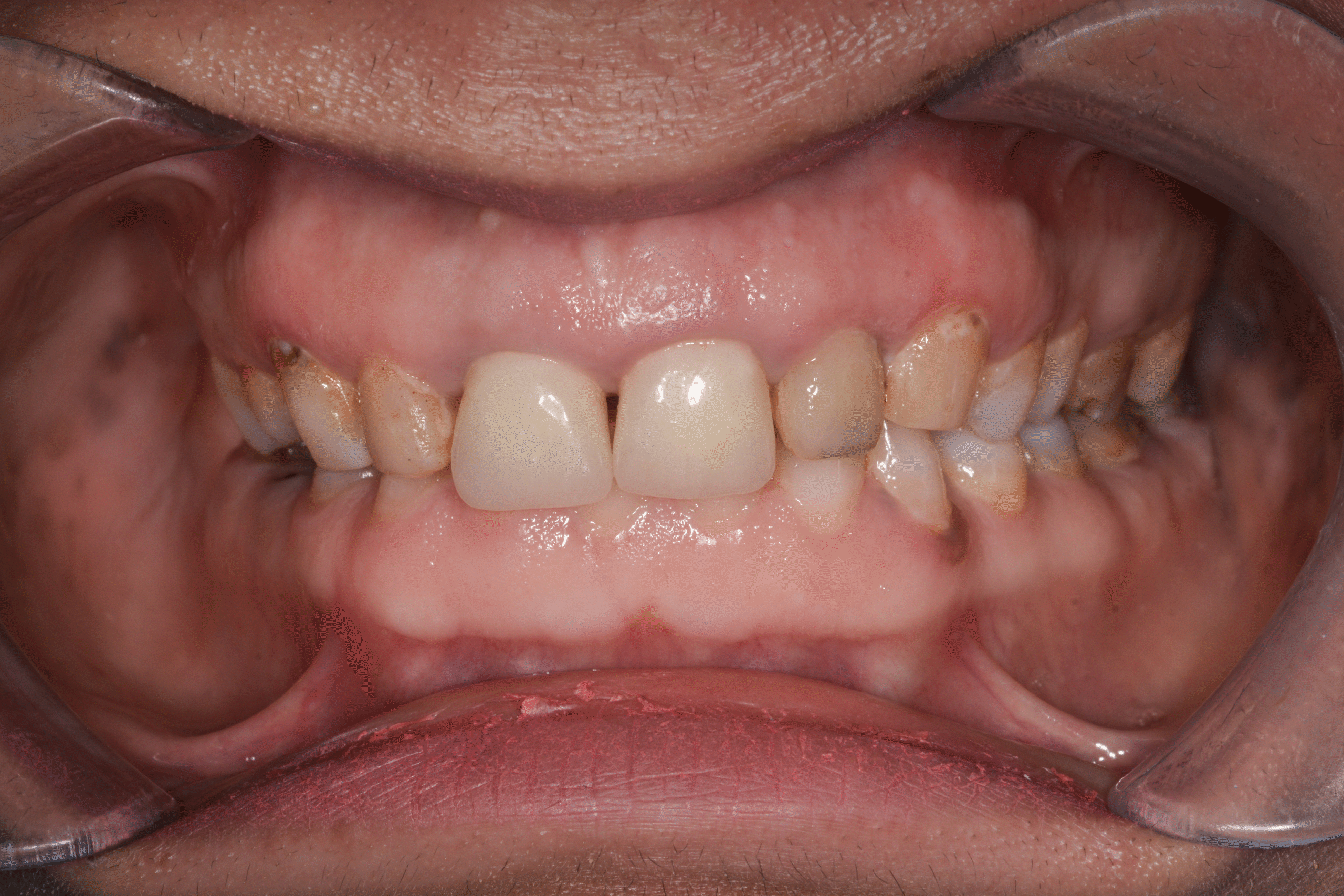 Before image alt